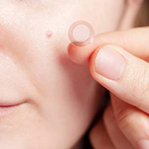 Pimple Acne Spot Treatment