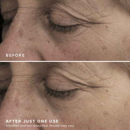 Revitalizing Eye Brighteners