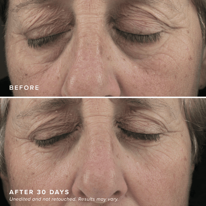Revitalizing Eye Brighteners